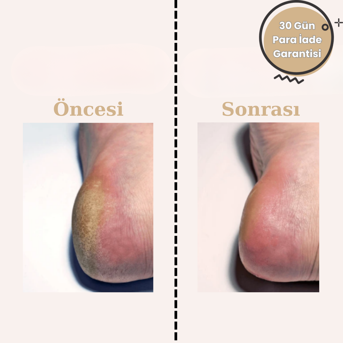PureSole
